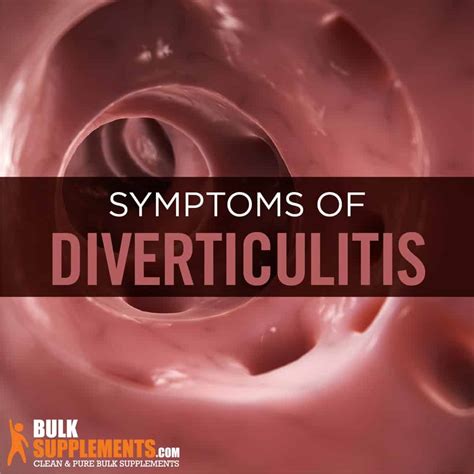 Diverticulitis: Symptoms, Causes & Treatment