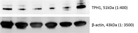 Tryptophan Hydroxylase 1/TPH-1 Antibody (NBP1-86922): Novus Biologicals