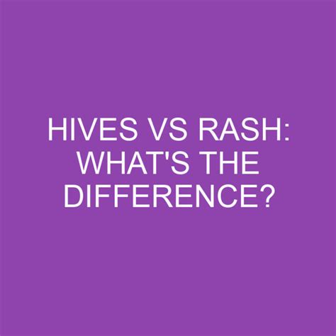 Hives Vs Rash: What's The Difference? » Differencess