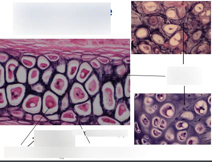 Elastic Cartilage Diagram | Quizlet