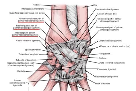 Wrist Sprain - Physiopedia