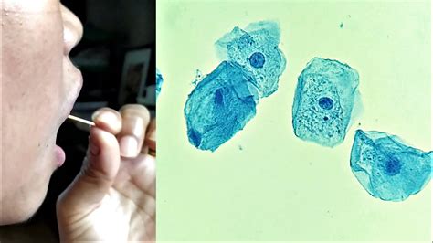 Cheek Cells Under Microscope Labeled