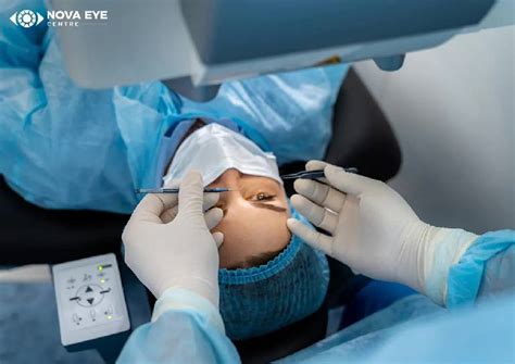 Types of Laser Eye Surgery | Nova Eye Centre