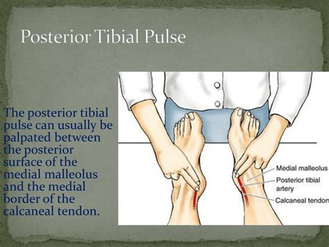 Posterior Tibialis Pulse