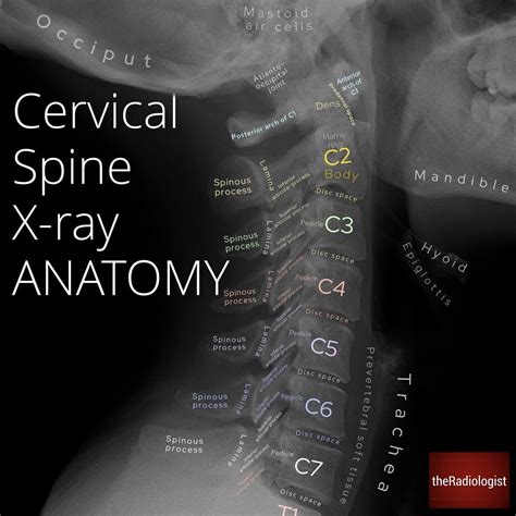 Radiographic Anatomy Of The Cervical Spine Quick Version – NBKomputer