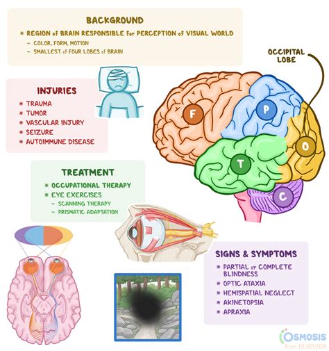 Occipital Lobe: What Is It, Its Function | Osmosis