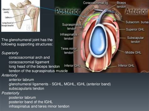 Shoulder labral tears MRI