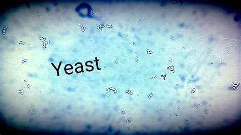 bacteria urine sediment microscopy