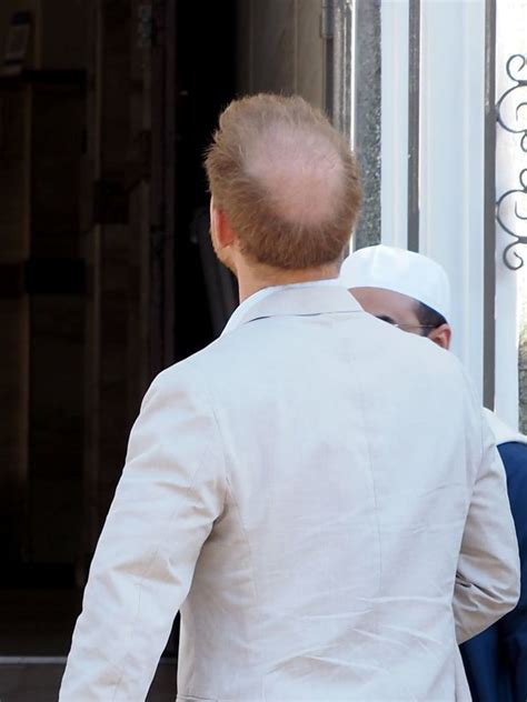 Prince Harry’s huge bald spot pictured on South Africa mosque visit ...