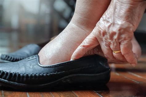 Elderly Woman Swollen Feet Putting on Shoes Stock Photo - Image of ...