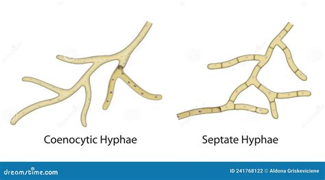 The Structure Of A Fungal Hyphae. Coenocytic Hyphae, Septate Hyphae ...