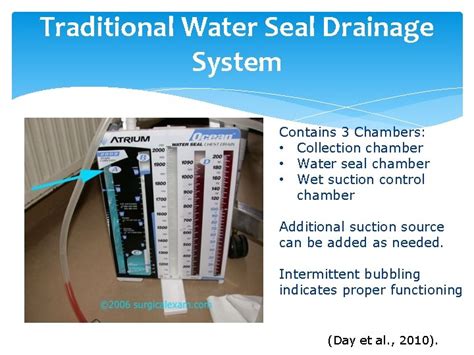 Under Water Seal Drainage Indications - Best Drain Photos Primagem.Org