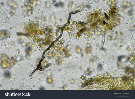 Fungal Fungi Hyphae Under Microscope Soil Stock Photo 2183425211 ...