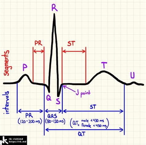 Ecg Intervals And Segments | Hot Sex Picture