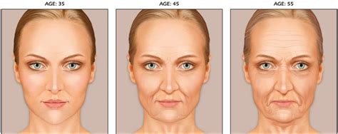 The Skin and the Aging Process