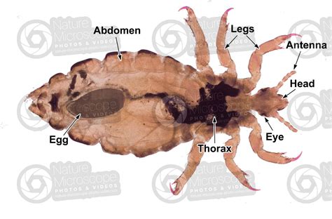 Pediculus humanus capitis. Head louse. Pediculosis. Ventral view - Lice ...