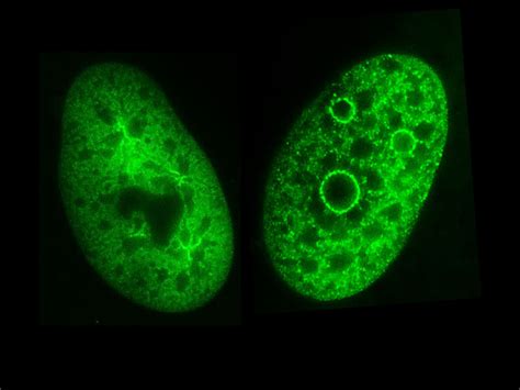 Histone chaperones: Structure, function and role in development and disease