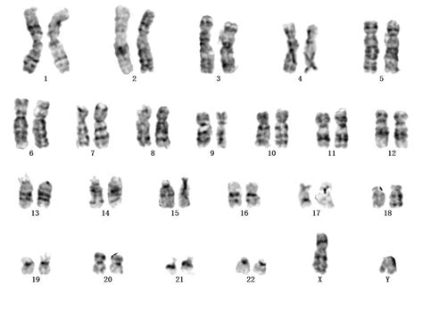 In The Human Karyotype Above What Are The Chromosomes In Each Numbered ...