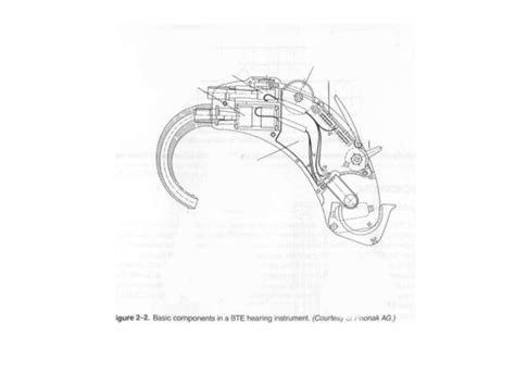 Hearing aid anatomy Diagram | Quizlet