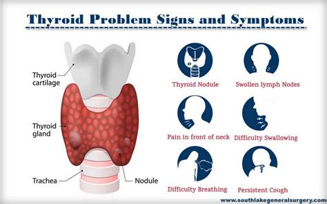 Know More About Thyroid Treatment and Surgery - Southlake General Surgery