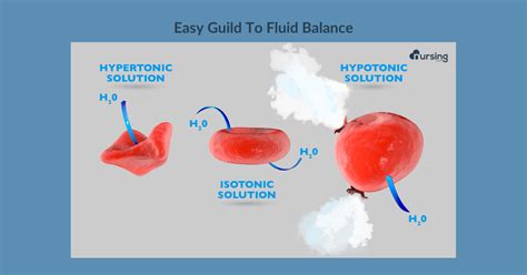 Hypertonic, Hypotonic, Isotonic . . . What-the-Tonic? | NURSING.com