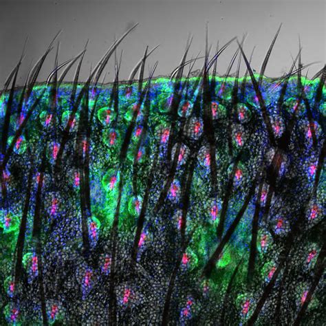 Watt Lab | Research Image | Mouse skin cells