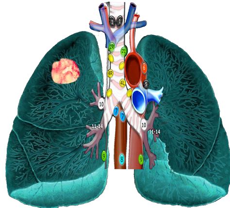 Mediastinal Lymph Node Anatomy