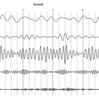 6: EEG frequency bands (Bedard et al., 2010) | Download Scientific Diagram