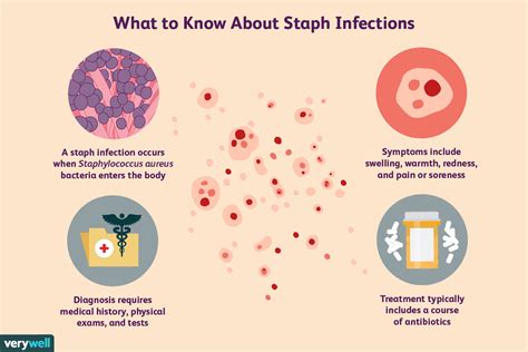 How To Cure A Staph Infection - Amountaffect17