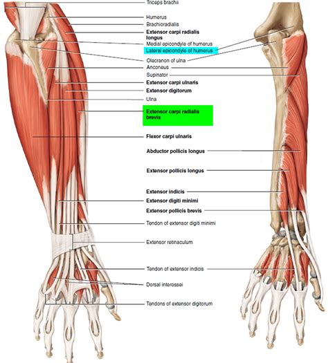 [DIAGRAM] Arm Tendons Diagram - MYDIAGRAM.ONLINE