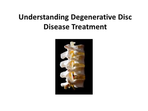 Degenerative Disc Disease Treatment