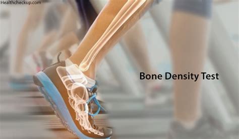 Bone Density Test Preparation, Procedure, Results Interpretation by Dr ...