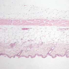 3 Histology of normal mouse skin Normal mouse skin (HE stain). The ...