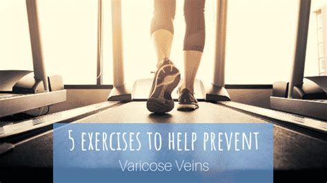 5 Exercises to Help Prevent Varicose Veins | Summit Skin & Vein Care