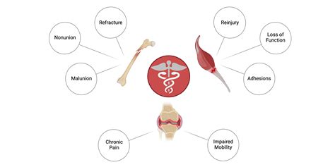 Orthopedic Complications | BioRender Science Templates