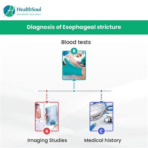 Esophageal Stricture: Symptoms, Causes and Treatment – Healthsoul