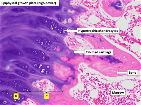 Histology Of Bone | Hot Sex Picture