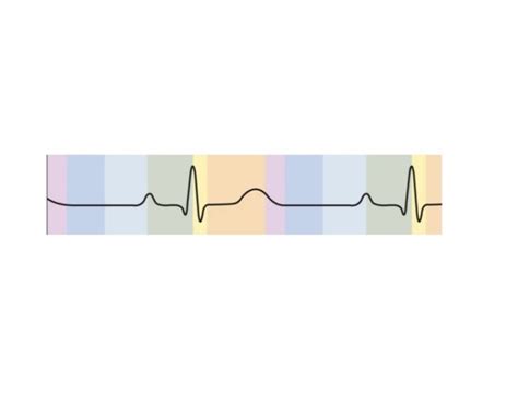 Electrical Quiz