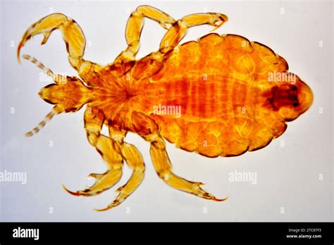 Head louse (Pediculus humanus capitis) complet specimen. Light ...