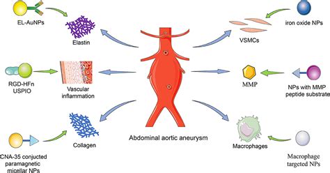 Aortic aneurysm - KaitlenEsmie