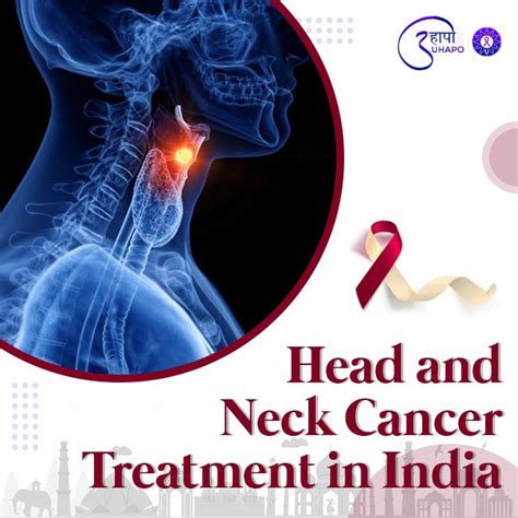 Advanced Head and Neck Cancer Treatment in India | Uhapo