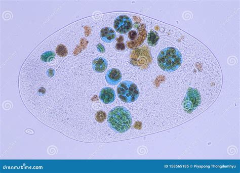 Frontonia Sp. Unicellular Ciliate Protists Under The Microscope. Stock ...