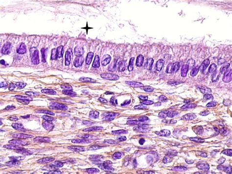 Endocervix Histology