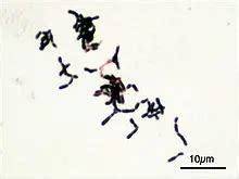 5 Non Pathogenic Bacteria Examples :Detailed Explanations - LAMBDAGEEKS