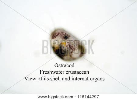 Microscopic Freshwater Image & Photo (Free Trial) | Bigstock