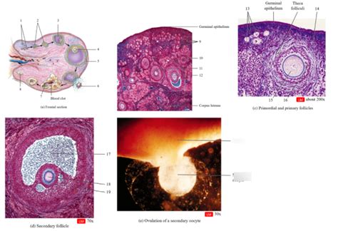 Graafian Follicle Histology Labeled