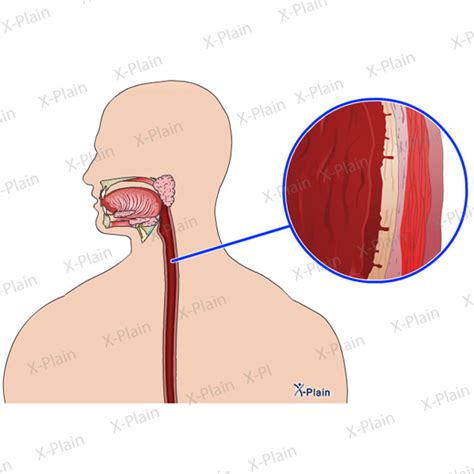 Esophagus Layers