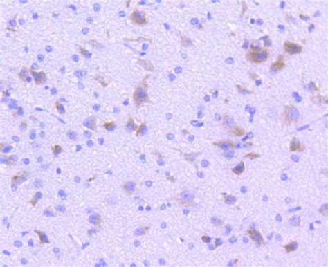 Tryptophan Hydroxylase 1 (TPH1) Rabbit mAb - SAB | Signalway Antibody