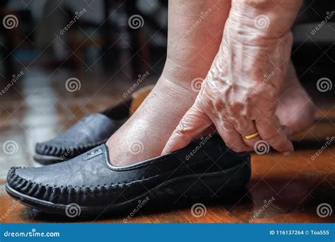 Elderly Woman Swollen Feet Putting on Shoes Stock Photo - Image of ...