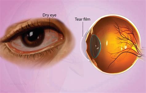 Health Symptoms : Causes, Treatment, Conditions and More